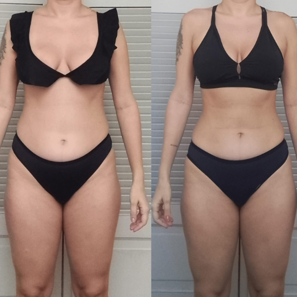 ANTES E DEPOIS BRANDÃO (4)