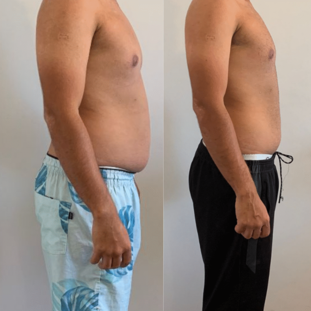 ANTES E DEPOIS BRANDÃO (5)