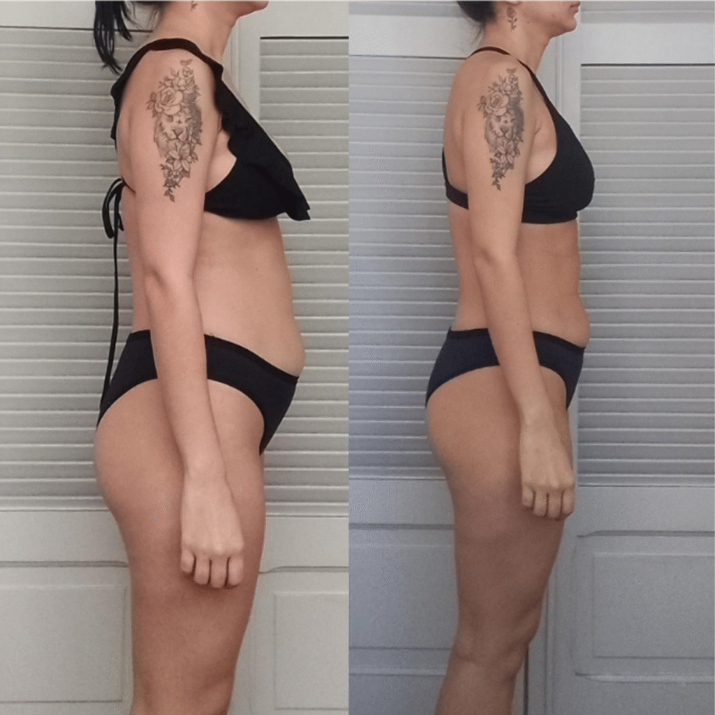 ANTES E DEPOIS BRANDÃO (6)